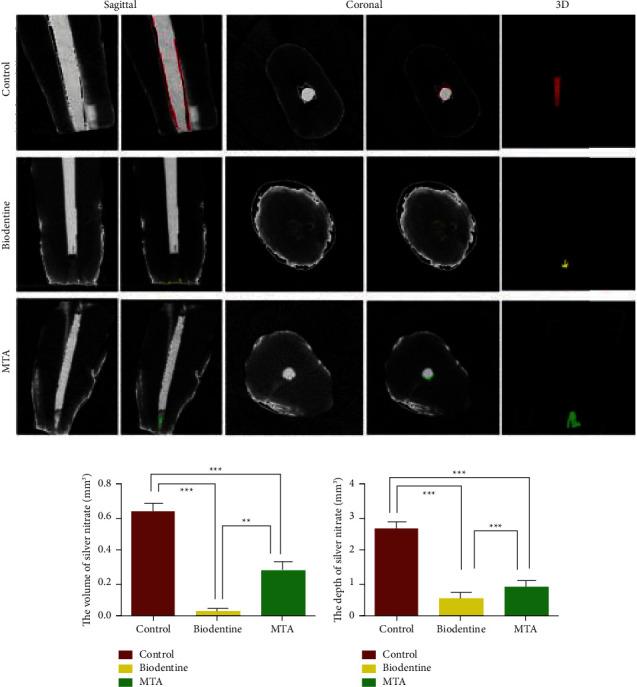 https://cdn.ncbi.nlm.nih.gov/pmc/blobs/55a5/9637478/df285f7c6fa7/IJD2022-6858088.002.jpg