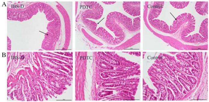 https://cdn.ncbi.nlm.nih.gov/pmc/blobs/55ab/5768377/a0905b34f428/oncotarget-08-113957-g004.jpg