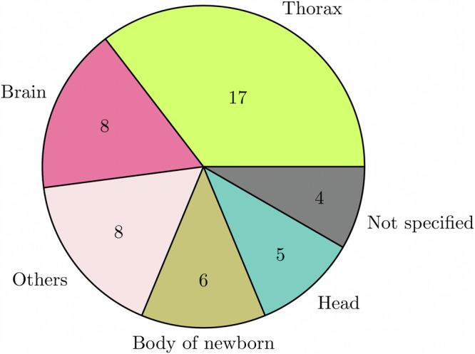 https://cdn.ncbi.nlm.nih.gov/pmc/blobs/55ae/11344824/5df41d61bc76/41746_2024_1219_Fig4_HTML.jpg
