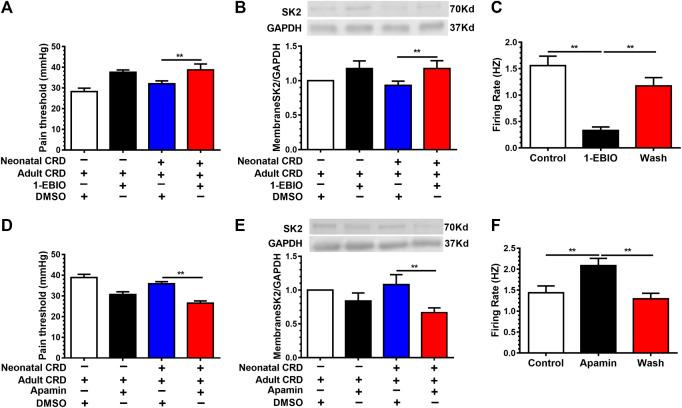 https://cdn.ncbi.nlm.nih.gov/pmc/blobs/55b4/7873043/6f21707a6eca/fphar-11-605618-g004.jpg