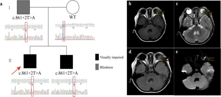 https://cdn.ncbi.nlm.nih.gov/pmc/blobs/55ba/12130007/3d43bb8d7987/fonc-15-1525035-g001.jpg