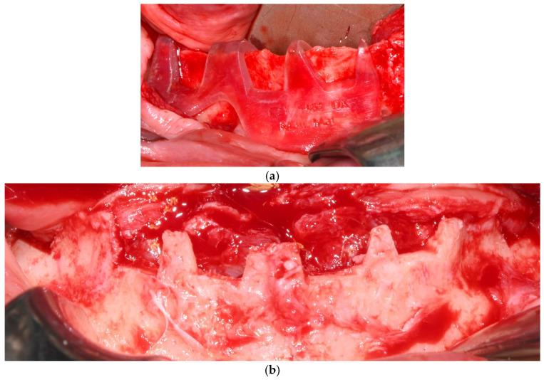 https://cdn.ncbi.nlm.nih.gov/pmc/blobs/55ba/12384704/c82647f7a94e/dentistry-13-00337-g003.jpg