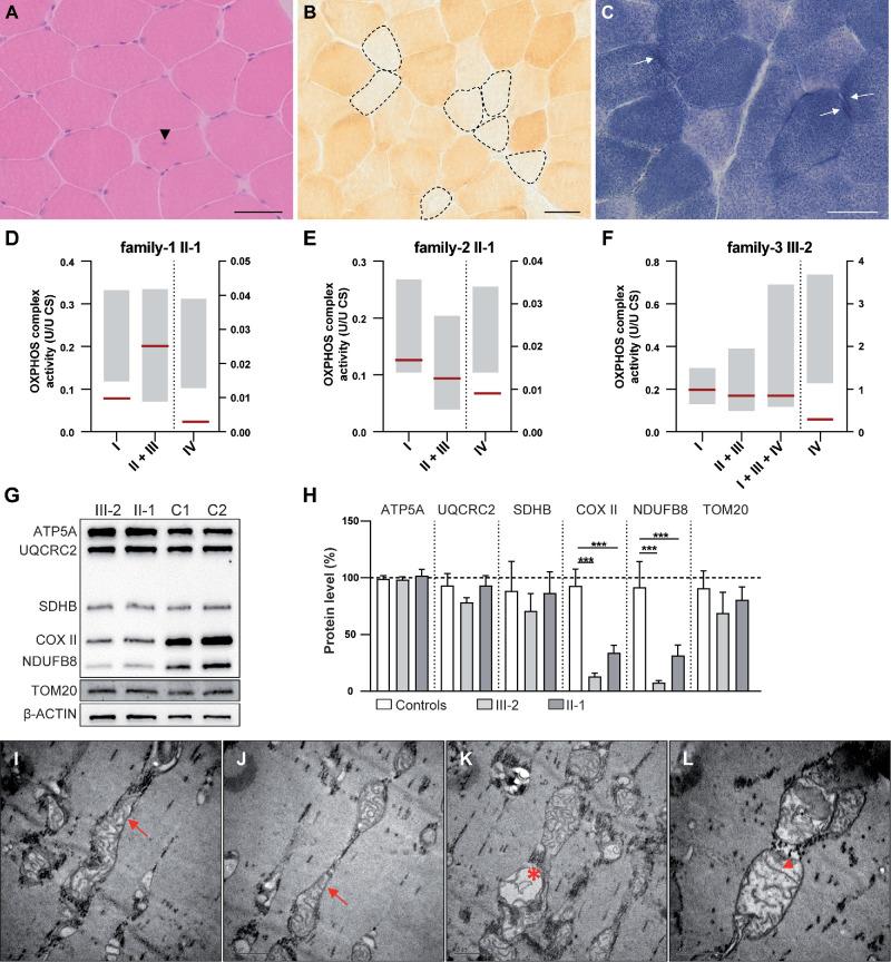 https://cdn.ncbi.nlm.nih.gov/pmc/blobs/55c2/12147050/3627eed67b57/iovs-66-6-17-f005.jpg