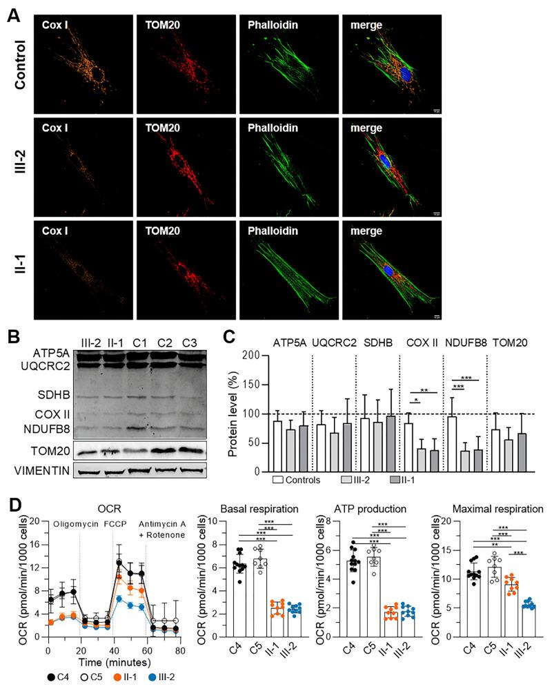 https://cdn.ncbi.nlm.nih.gov/pmc/blobs/55c2/12147050/67ac38e0a06b/iovs-66-6-17-f006.jpg