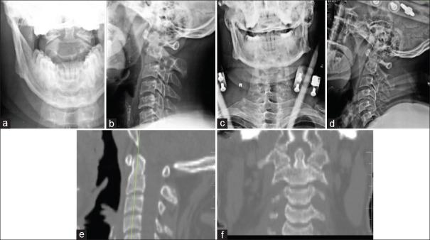 https://cdn.ncbi.nlm.nih.gov/pmc/blobs/55ca/12313038/39d74470106c/JCVJS-16-224-g007.jpg