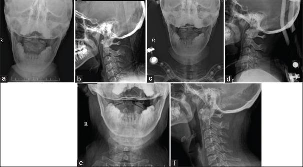 https://cdn.ncbi.nlm.nih.gov/pmc/blobs/55ca/12313038/e36fddaeb72e/JCVJS-16-224-g006.jpg