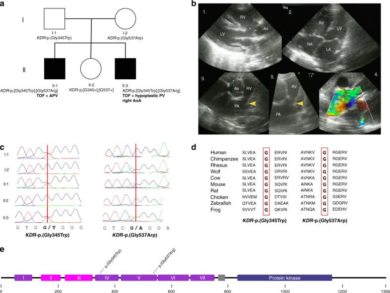 https://cdn.ncbi.nlm.nih.gov/pmc/blobs/55ca/8486653/ca042eb80e2f/41436_2021_1212_Fig1_HTML.jpg