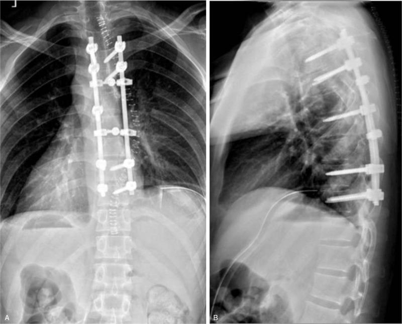 https://cdn.ncbi.nlm.nih.gov/pmc/blobs/55cb/6775359/2480a9a6a552/medi-98-e17144-g007.jpg