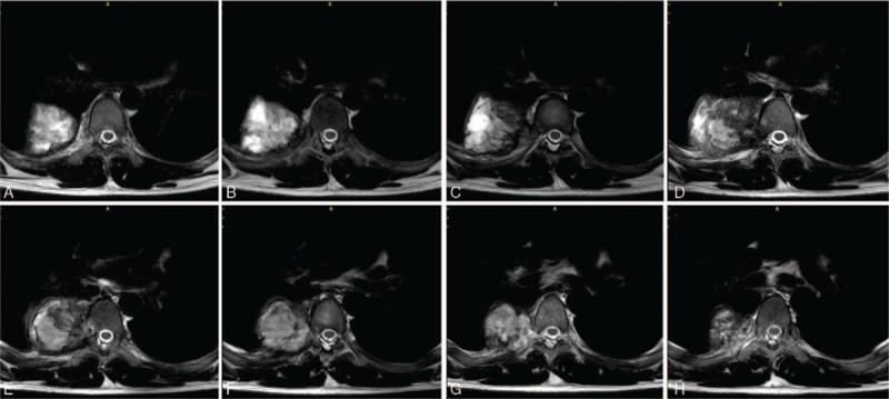 https://cdn.ncbi.nlm.nih.gov/pmc/blobs/55cb/6775359/92eb95d0c064/medi-98-e17144-g004.jpg