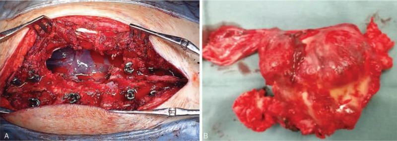 https://cdn.ncbi.nlm.nih.gov/pmc/blobs/55cb/6775359/9c436d17db45/medi-98-e17144-g006.jpg