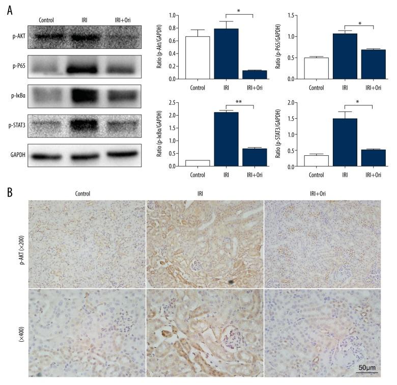 https://cdn.ncbi.nlm.nih.gov/pmc/blobs/55cb/7219002/c45c51a93cbf/medscimonit-26-e921114-g005.jpg
