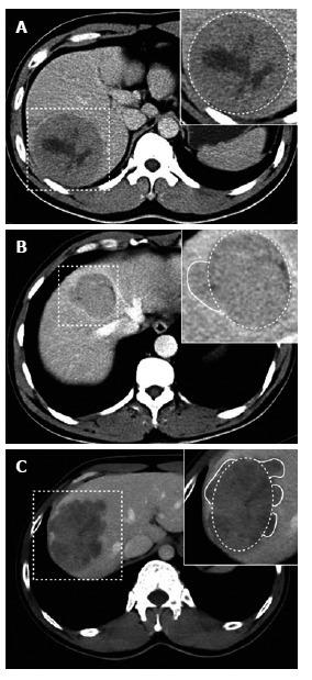 https://cdn.ncbi.nlm.nih.gov/pmc/blobs/55d0/5643272/92cf86eb8ffc/WJG-23-6467-g001.jpg