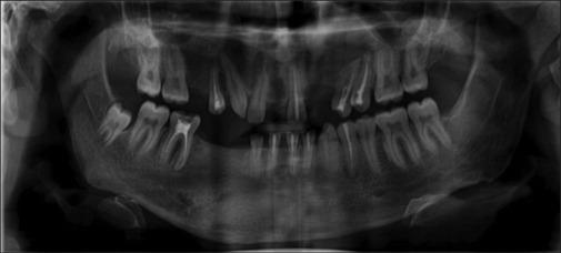 https://cdn.ncbi.nlm.nih.gov/pmc/blobs/55d4/10855513/462b67842c65/CCD-14-317-g008.jpg