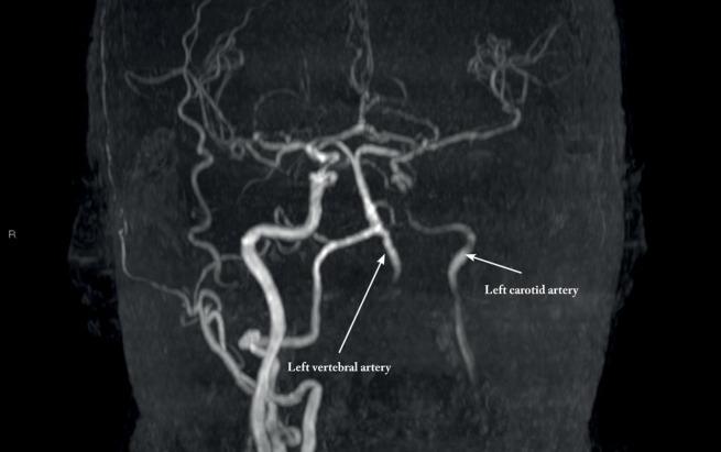 https://cdn.ncbi.nlm.nih.gov/pmc/blobs/55d4/9766845/f2d5c54ee17c/SVDLD-39-27-g001.jpg