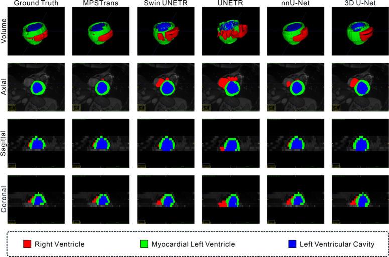 https://cdn.ncbi.nlm.nih.gov/pmc/blobs/55d6/12381746/380b45f22c4b/im4c00102_0007.jpg