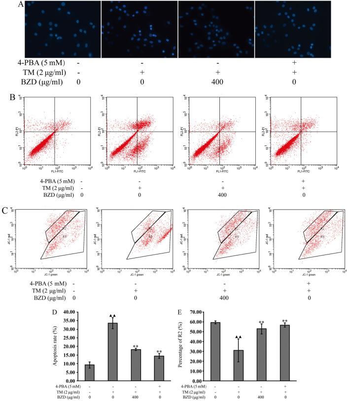 https://cdn.ncbi.nlm.nih.gov/pmc/blobs/55d7/4678159/79c1b6d461db/IJMM-36-06-1519-g04.jpg