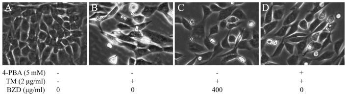 https://cdn.ncbi.nlm.nih.gov/pmc/blobs/55d7/4678159/dd243867cbe4/IJMM-36-06-1519-g03.jpg