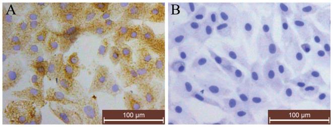 https://cdn.ncbi.nlm.nih.gov/pmc/blobs/55d7/4678159/ee4d7ddde6ff/IJMM-36-06-1519-g01.jpg