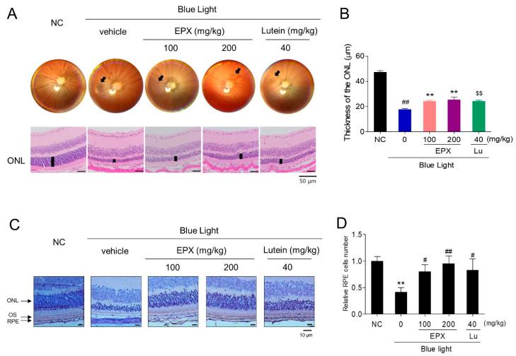 https://cdn.ncbi.nlm.nih.gov/pmc/blobs/55e5/7912168/4bcd975ac8f3/nutrients-13-00359-g008.jpg