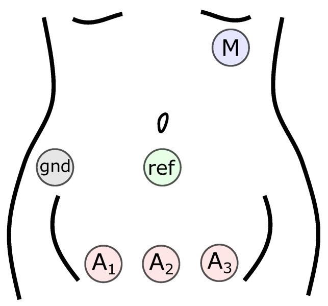 https://cdn.ncbi.nlm.nih.gov/pmc/blobs/55e8/9103336/1bb8e9c5a4c9/sensors-22-03303-g002.jpg