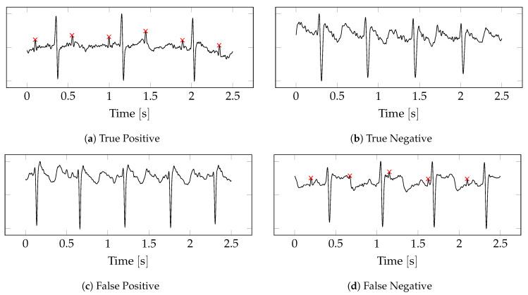 https://cdn.ncbi.nlm.nih.gov/pmc/blobs/55e8/9103336/419d8e71e7df/sensors-22-03303-g008.jpg