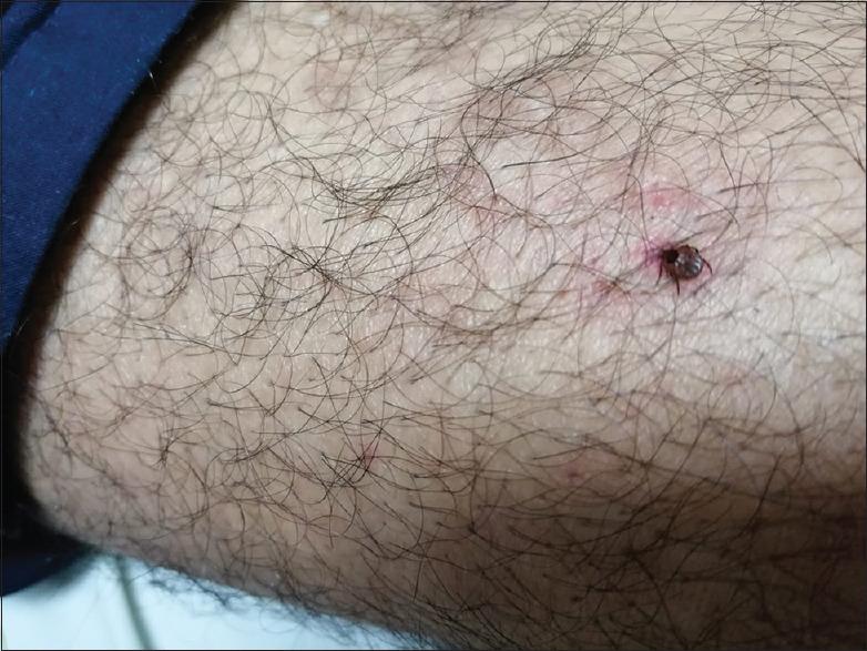 https://cdn.ncbi.nlm.nih.gov/pmc/blobs/55eb/9638632/3c46c6843cc1/JFMPC-11-4824-g002.jpg