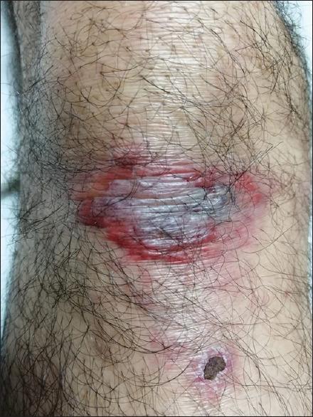 https://cdn.ncbi.nlm.nih.gov/pmc/blobs/55eb/9638632/a551770859a4/JFMPC-11-4824-g001.jpg