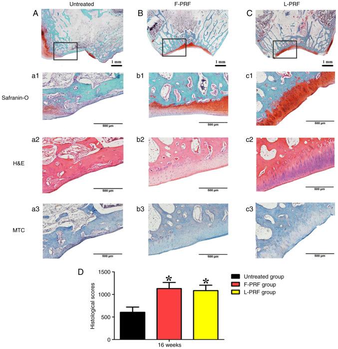 https://cdn.ncbi.nlm.nih.gov/pmc/blobs/55ed/10632968/60ea264b2fa0/etm-26-06-12268-g03.jpg