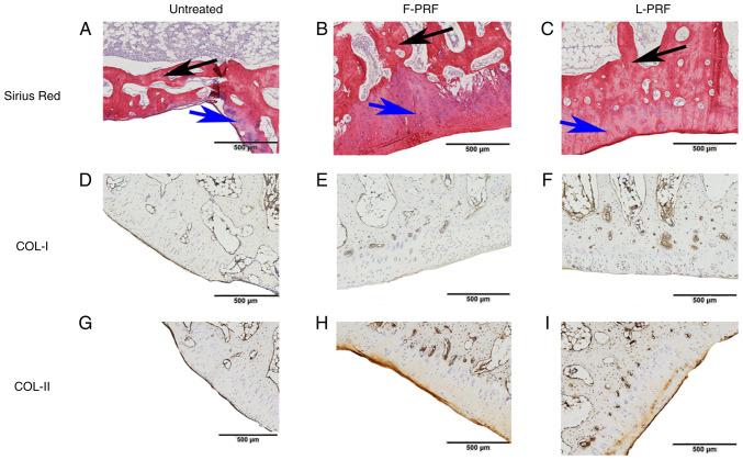 https://cdn.ncbi.nlm.nih.gov/pmc/blobs/55ed/10632968/ec6846997256/etm-26-06-12268-g04.jpg