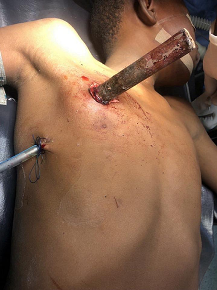 https://cdn.ncbi.nlm.nih.gov/pmc/blobs/55f5/9482237/cd11c360c2ce/PAMJ-42-155-g001.jpg