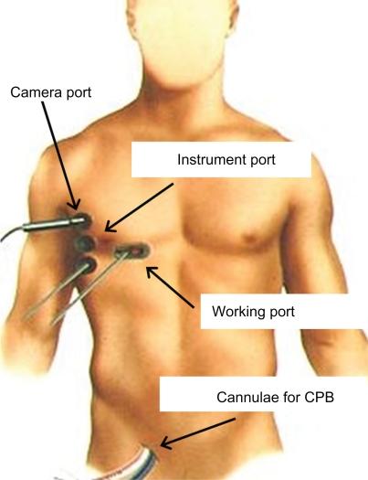 https://cdn.ncbi.nlm.nih.gov/pmc/blobs/55f7/2922304/326b91078088/vhrm-6-439f2.jpg