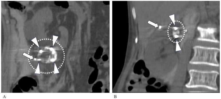 https://cdn.ncbi.nlm.nih.gov/pmc/blobs/55ff/11598556/5d4e9f43b1f9/tomography-10-00130-g002.jpg