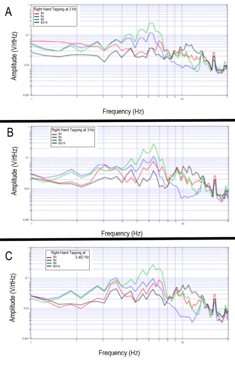 https://cdn.ncbi.nlm.nih.gov/pmc/blobs/55ff/9001246/58913c11c343/cureus-0014-00000023006-i16.jpg