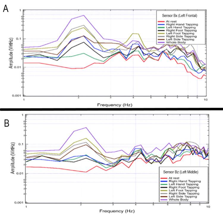 https://cdn.ncbi.nlm.nih.gov/pmc/blobs/55ff/9001246/e0ac49ae9ce3/cureus-0014-00000023006-i08.jpg