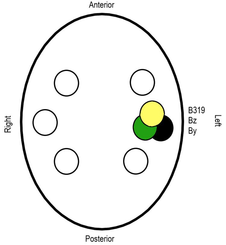 https://cdn.ncbi.nlm.nih.gov/pmc/blobs/55ff/9001246/f21b19fdb301/cureus-0014-00000023006-i02.jpg