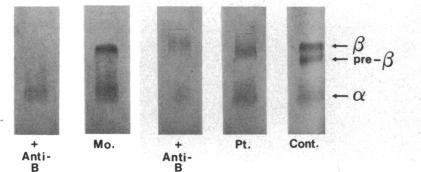 https://cdn.ncbi.nlm.nih.gov/pmc/blobs/5601/423826/4583a1210292/jcinvest00122-0027-c.jpg