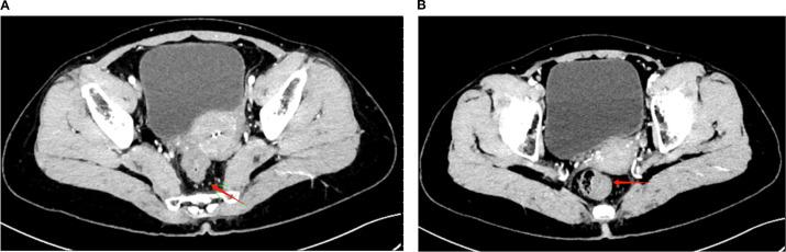 https://cdn.ncbi.nlm.nih.gov/pmc/blobs/5608/12404937/70e1098f47e9/fonc-15-1560508-g002.jpg