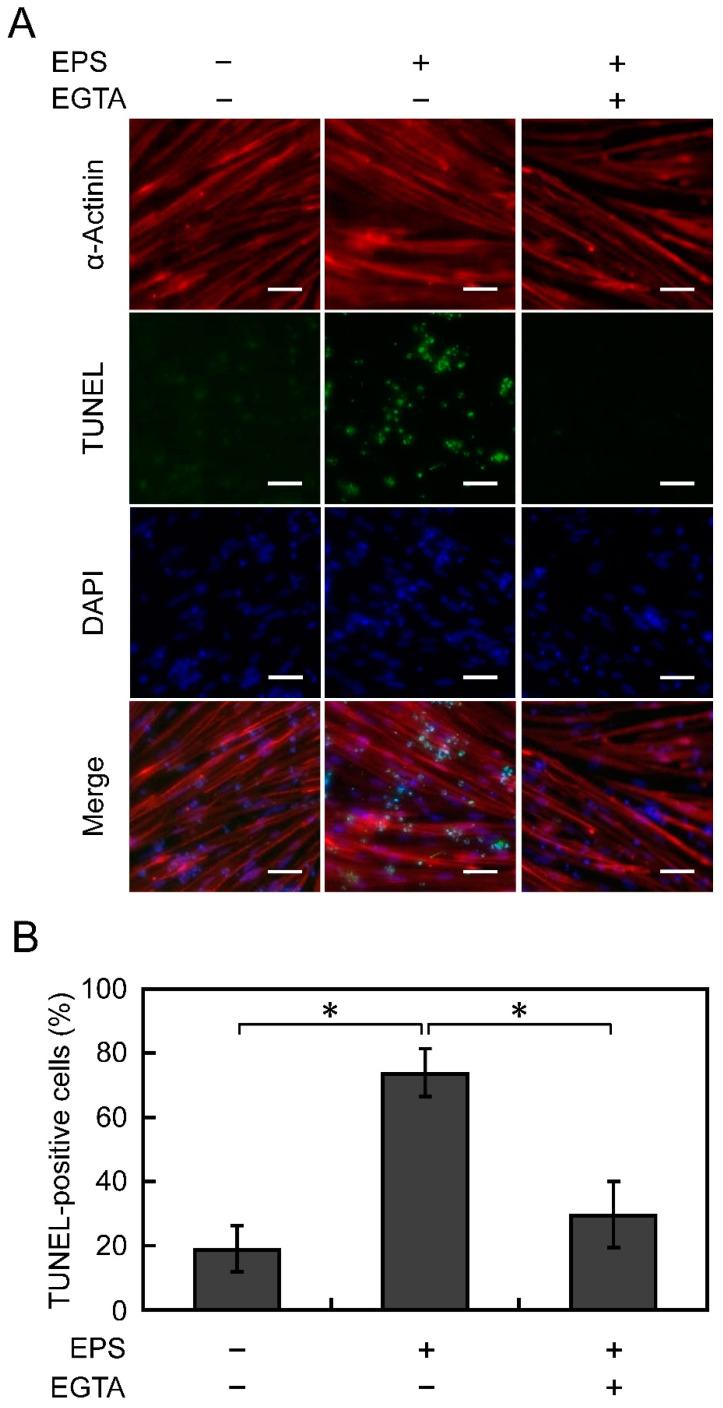 https://cdn.ncbi.nlm.nih.gov/pmc/blobs/560c/8534131/c2f316e34dfc/cells-10-02556-g004.jpg