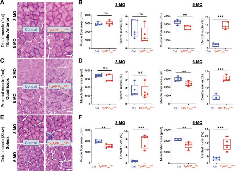 https://cdn.ncbi.nlm.nih.gov/pmc/blobs/5612/9649614/bcdfeb826948/41419_2022_5378_Fig1_HTML.jpg