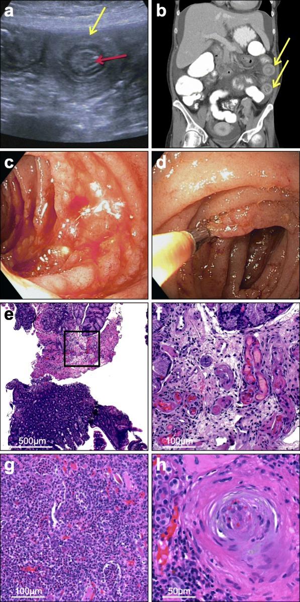 https://cdn.ncbi.nlm.nih.gov/pmc/blobs/5613/7092568/ec13b0812444/12882_2020_1766_Fig1_HTML.jpg