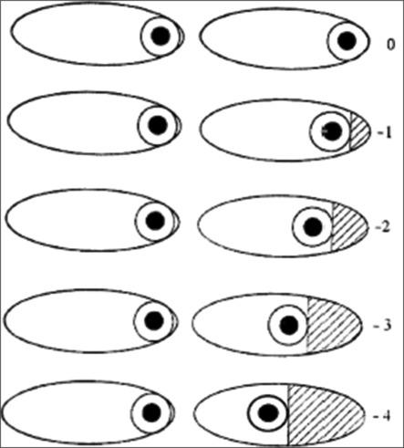 https://cdn.ncbi.nlm.nih.gov/pmc/blobs/5617/12121876/d02537ebf545/IJO-73-758-g003.jpg