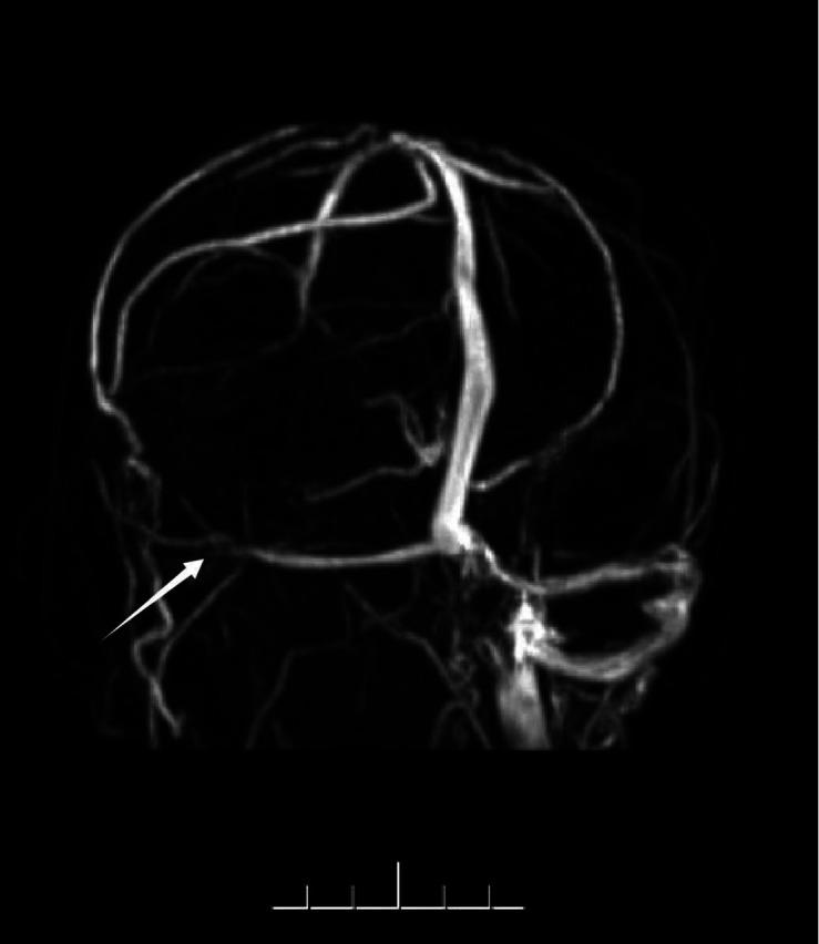 https://cdn.ncbi.nlm.nih.gov/pmc/blobs/5627/12334994/366620a4f66b/jiao-21-4-241804_f004.jpg