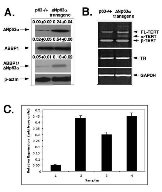 https://cdn.ncbi.nlm.nih.gov/pmc/blobs/562d/2815765/5ba6e4290c10/aging-01-058-g004.jpg