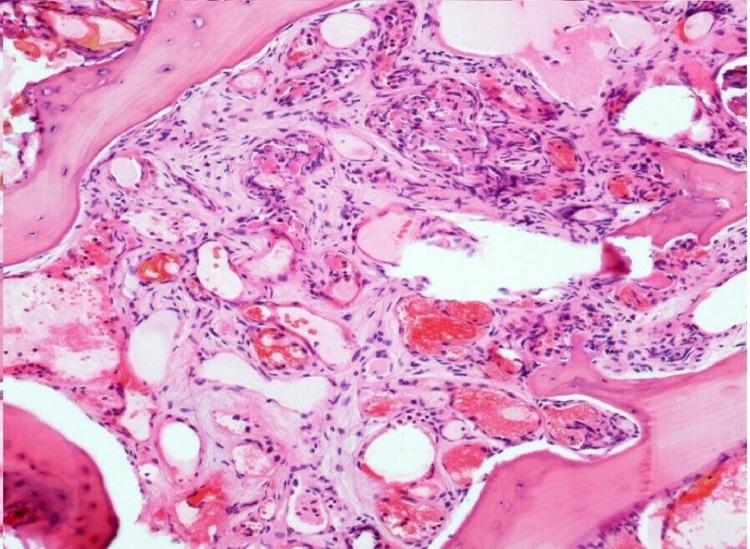 https://cdn.ncbi.nlm.nih.gov/pmc/blobs/562e/7890091/3f2b29665a2b/gr4.jpg