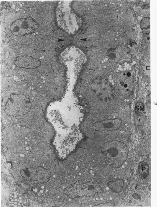https://cdn.ncbi.nlm.nih.gov/pmc/blobs/5634/2013434/18e50f816292/amjpathol00560-0025-a.jpg