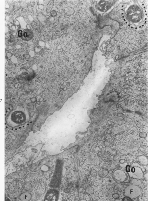https://cdn.ncbi.nlm.nih.gov/pmc/blobs/5634/2013434/4069483f729b/amjpathol00560-0018-a.jpg