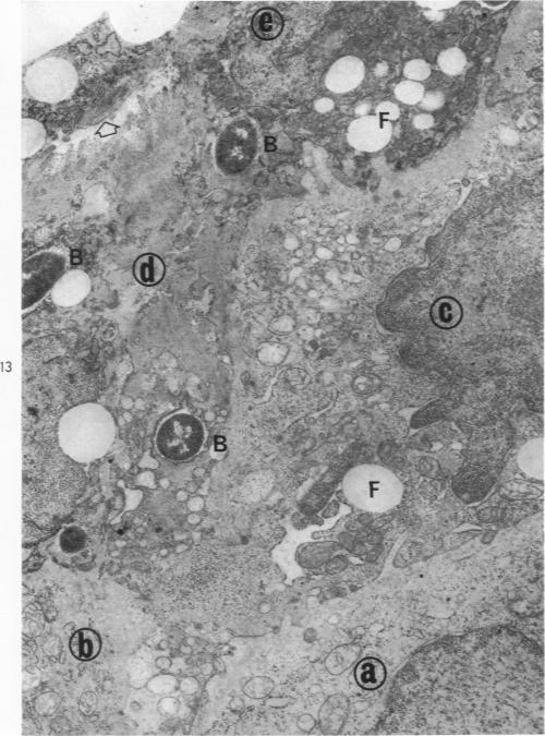 https://cdn.ncbi.nlm.nih.gov/pmc/blobs/5634/2013434/b8747d242cab/amjpathol00560-0024-a.jpg