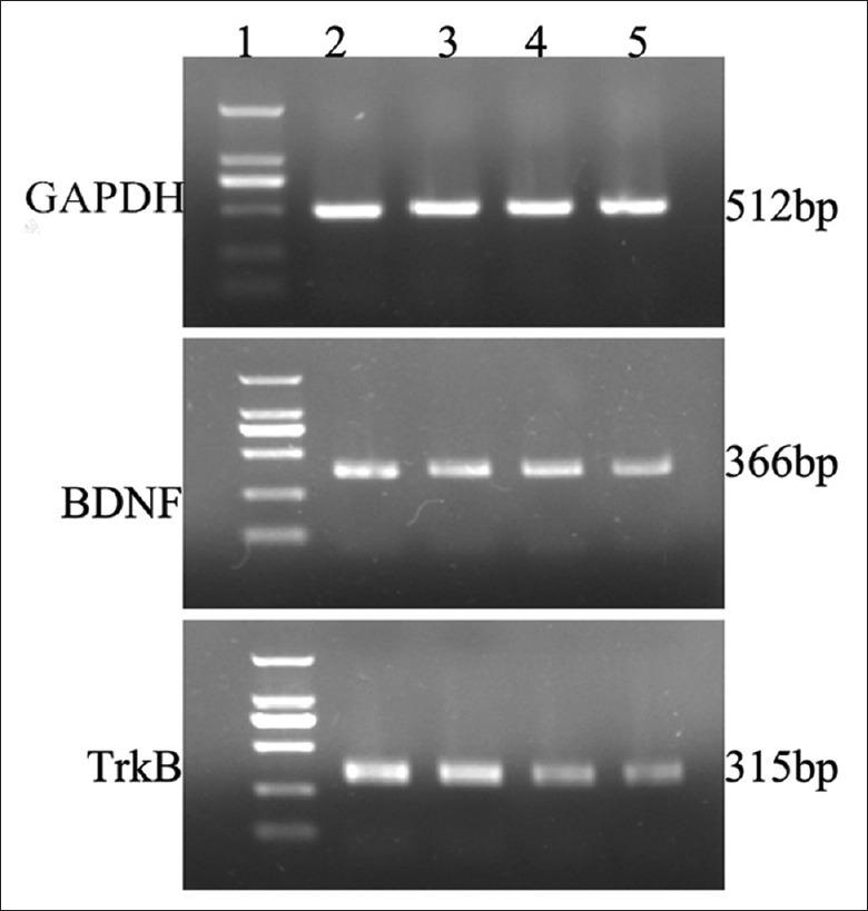 https://cdn.ncbi.nlm.nih.gov/pmc/blobs/5638/4756899/f9d9e6b2f9f3/CMJ-128-2926-g003.jpg