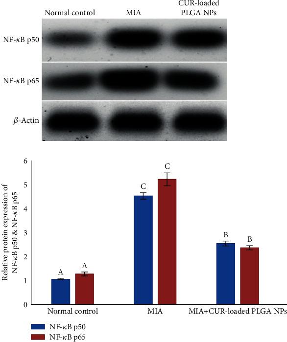 https://cdn.ncbi.nlm.nih.gov/pmc/blobs/5638/9792255/d8d050966281/MI2022-8353472.007.jpg
