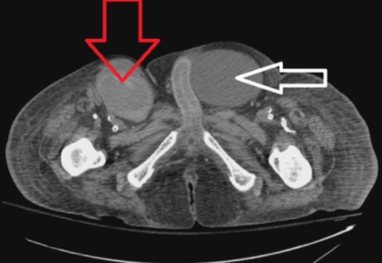 https://cdn.ncbi.nlm.nih.gov/pmc/blobs/563a/9001809/7d81f6ac2c38/cureus-0014-00000023045-i01.jpg